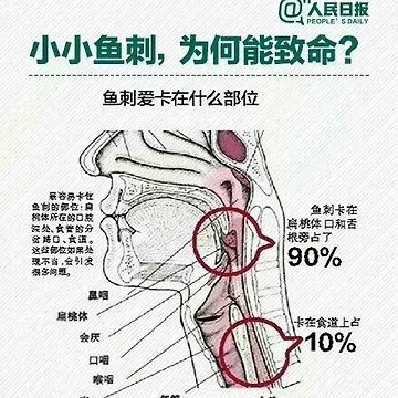 惊险生存挑战，鱼刺扎入心脏，丧命式自救后的重生之路