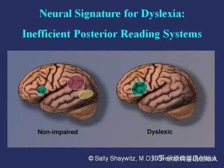 全球合作与英美两国选择，签署巴黎人工智能宣言的深层意义