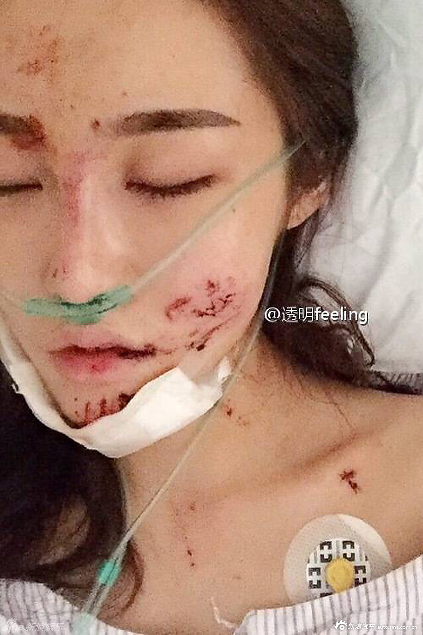 美女网红救人后离世，母亲遭遇车祸的不幸命运