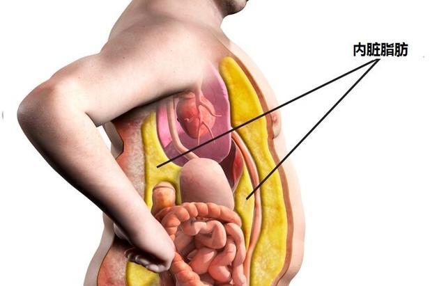 医生警告，内脏脂肪过多危害严重